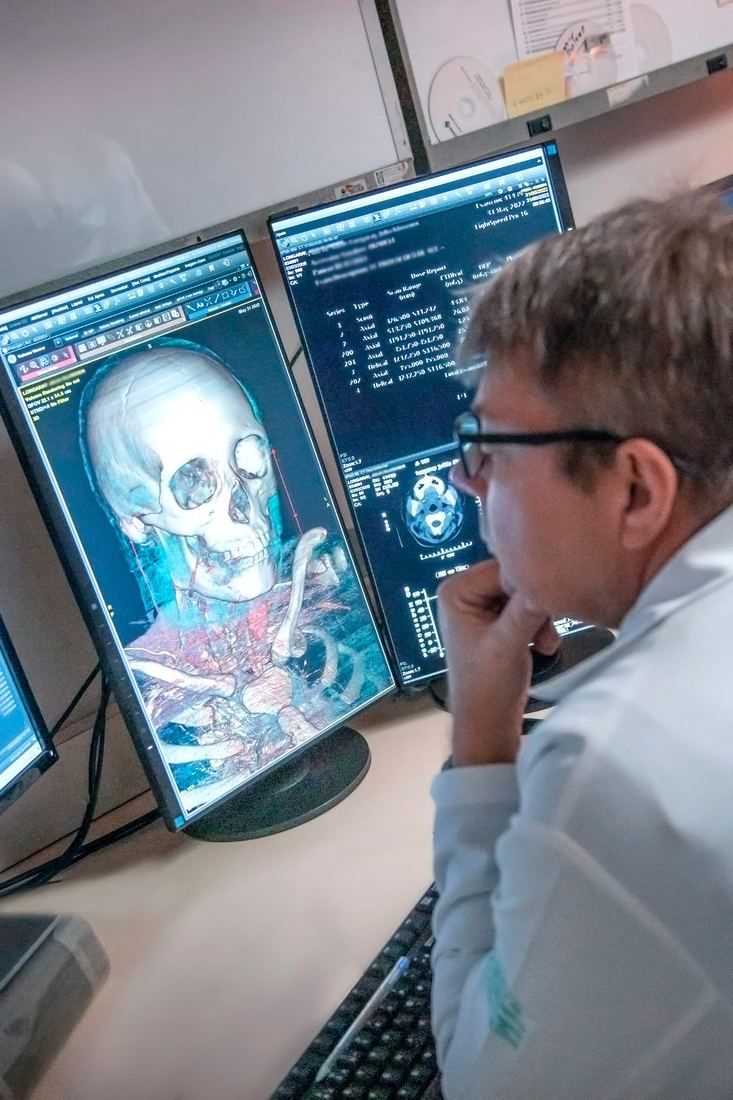 Radiologista analisando reconstrução 3D de tomografia