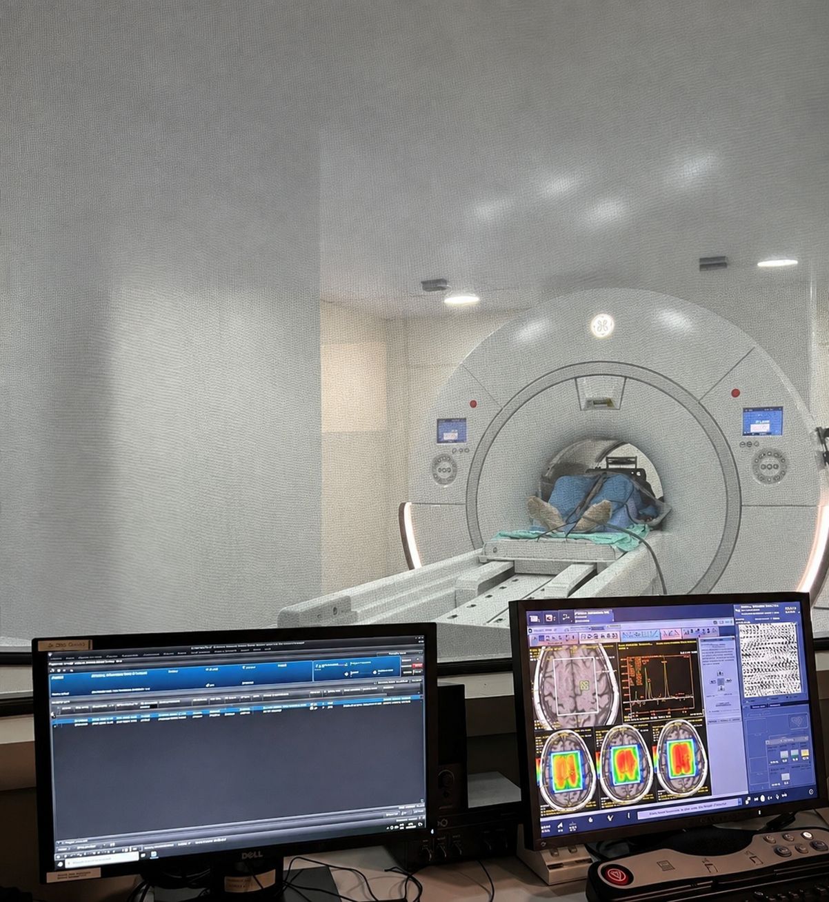 Sala de ressonância magnética